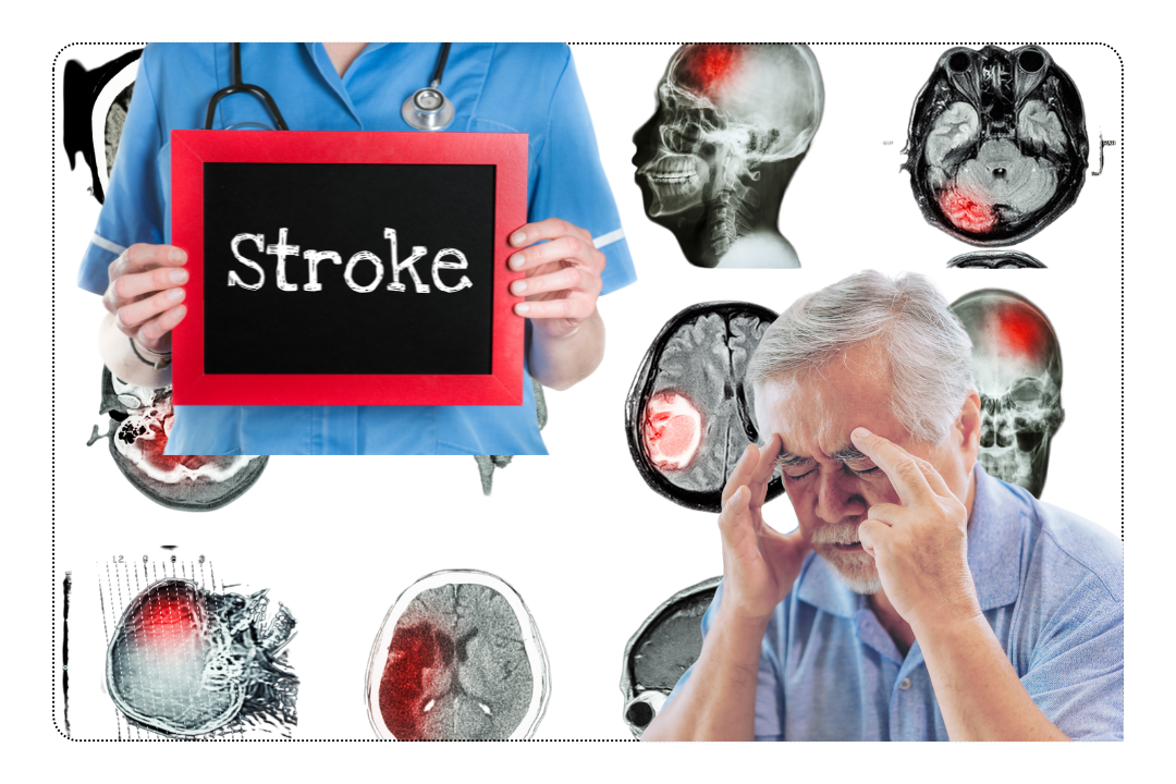 Stroke Recovery